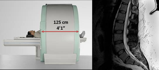 MRI of the Lumbar Spine